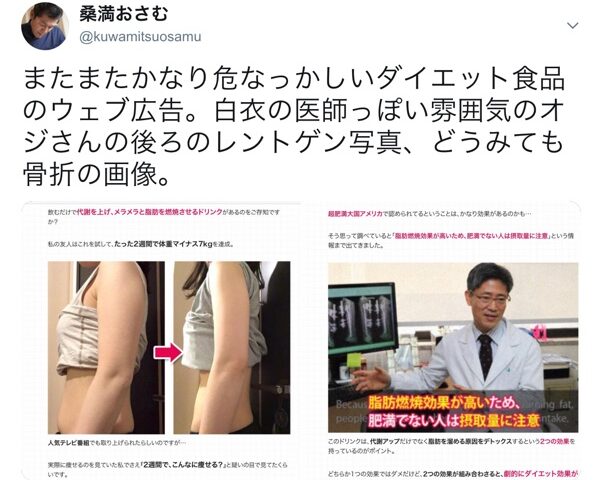 医師がオススメするダイエットサプリ？こんなインチキ広告に騙されてはダメ❗