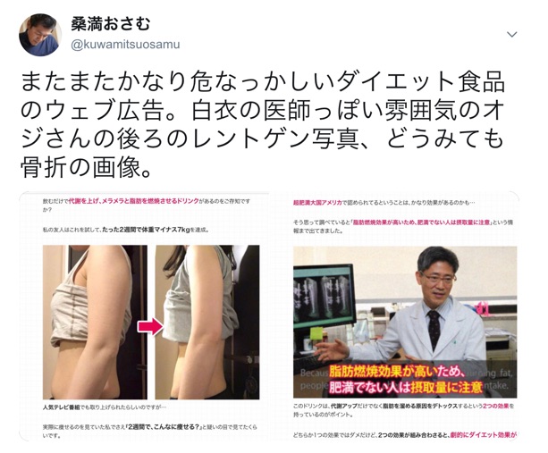 医師がオススメするダイエットサプリ こんなインチキ広告に騙されてはダメ 院長ブログ 五本木クリニック