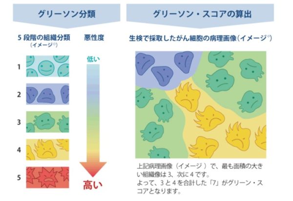 【第二弾】どうした「週刊現代」、デメリットが大きいと名医が断言する手術⁉