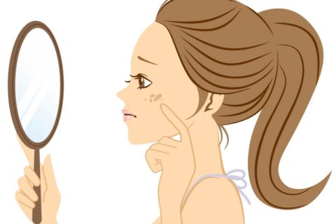 これから夏本番、美容皮膚科医がすすめる万全のシミ予防対策