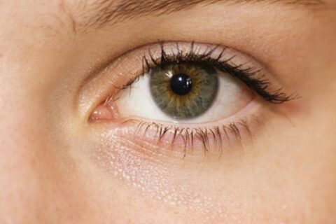 なぜ、一重まぶたの人は二重まぶたに憧れ、二重まぶたメイクや手術ををするのか?