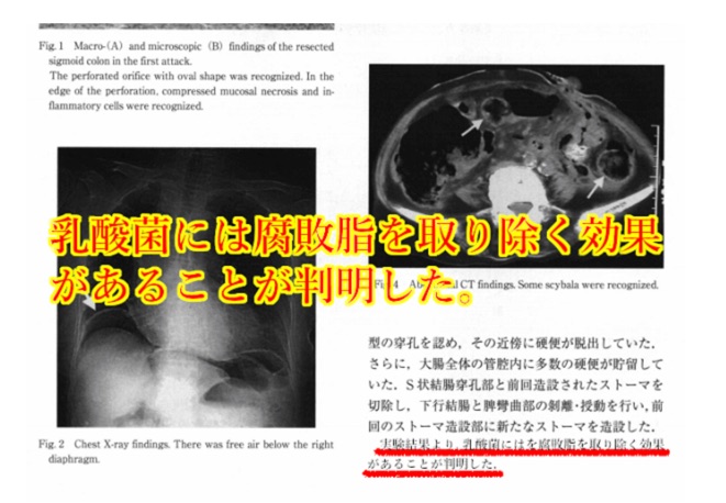 【医学論文改竄】ダイエットサプリの広告はここまでやるかぁ⁉