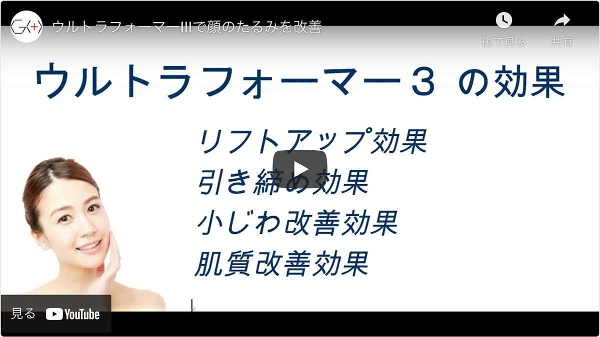 五本木クリニックのハイフシャワー施術動画