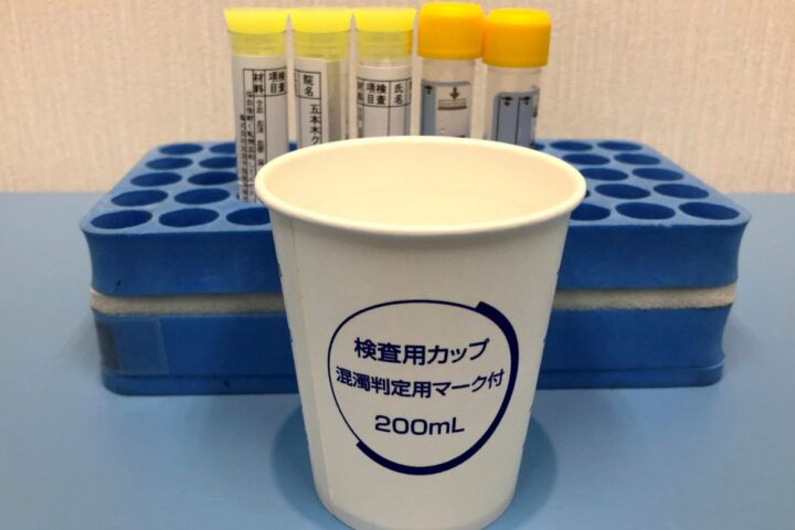 「頻尿なんです」じゃあ、尿を検査しますね。「おしっこが出ません」ええっ❗と泌尿器科医。