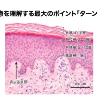 しみを消す治療の本質はターン・オーバーを理解すること