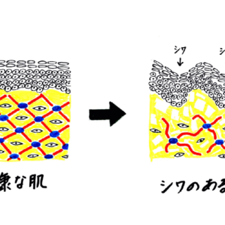 気になるシワの悩みを解決するための医療情報