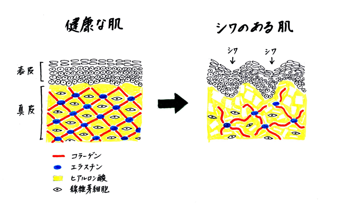 健康な肌としわのある肌