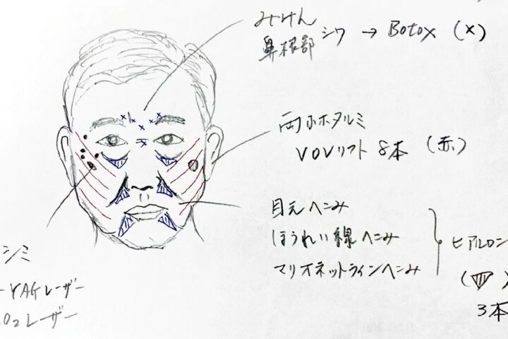 石破茂氏を10歳若返らせる治療プラン