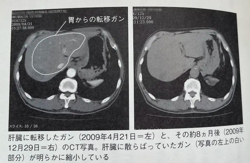 インチキCT画像