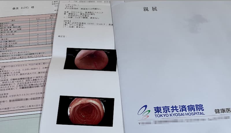 検査結果で陽性判定とか異常値と出てもパニックにならない為の知識