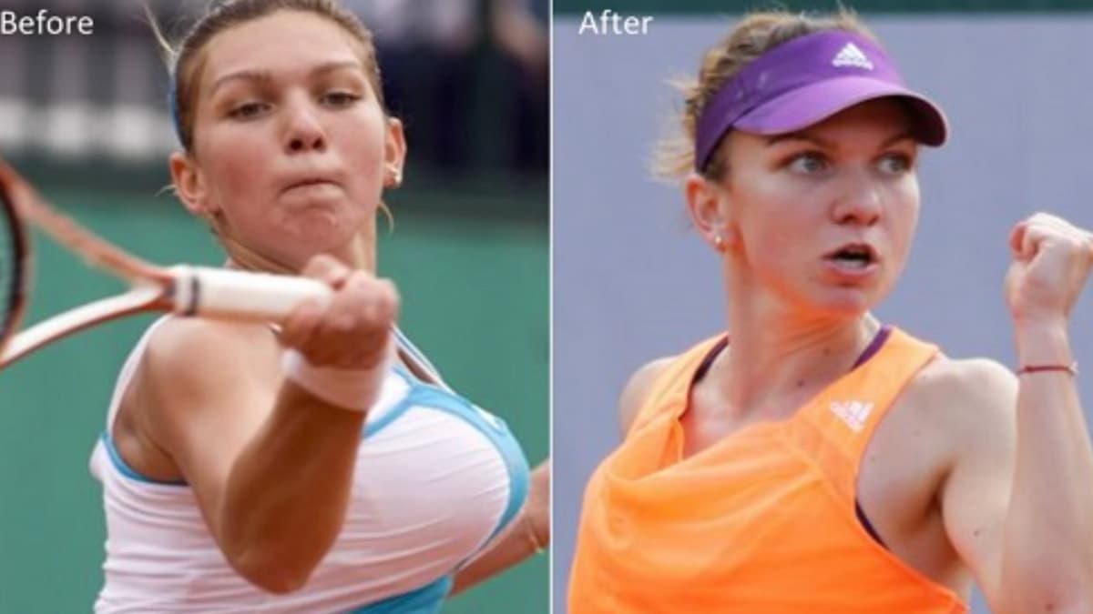 日本ではあまり希望者がいない乳房縮小術の効果をご紹介します。(院長ブログ) - 五本木クリニック