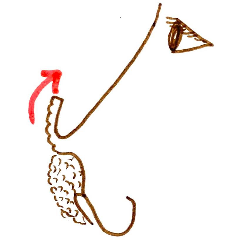 鼻の手術（オープン法を横から見た図）