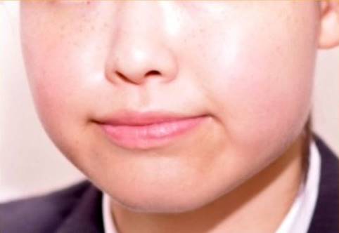 頬やあごの下に余分な脂肪があると顔が大きくなります