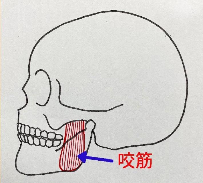 咬筋（こうきん）が発達しすぎるとエラが目立つよう