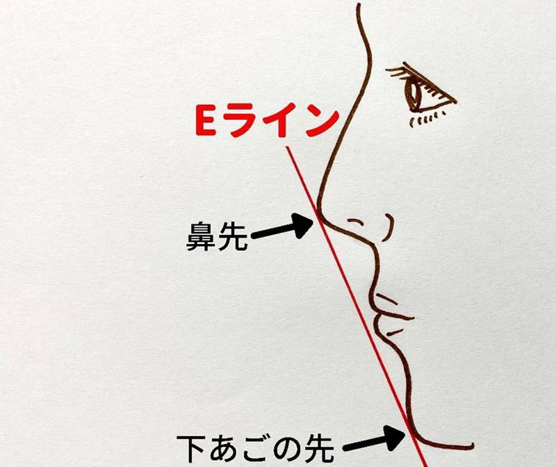 理想的な横顔の指標 Eライン とは 美に近づける治療法 Dr 松下ブログ 五本木クリニック