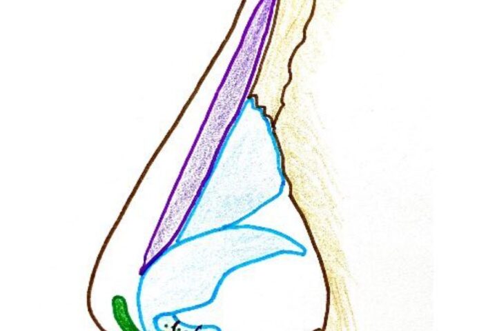 鼻先を高くするためのベストな方法とは？