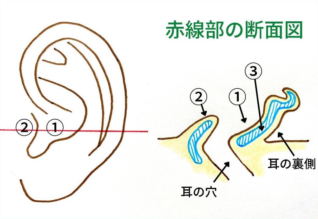 耳介軟骨