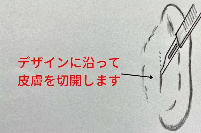 デザインに沿って右の耳の皮膚を切開します