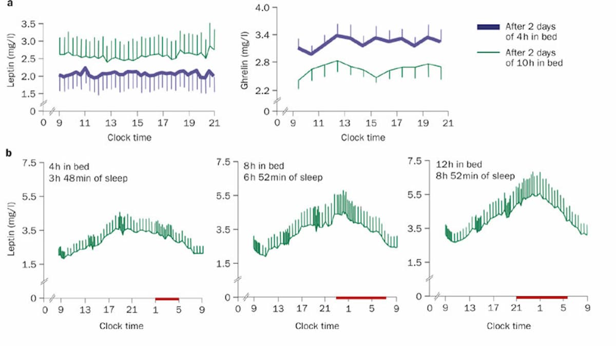 レプチンは乾癬にどのように影響しますか?