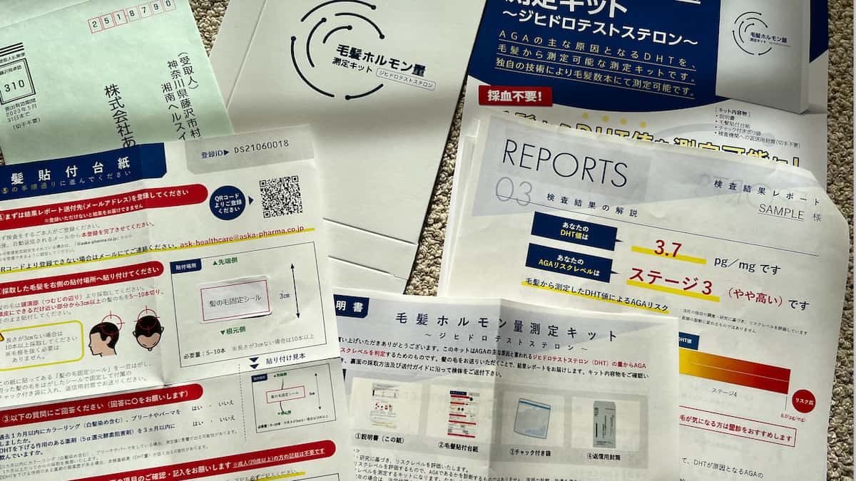薄毛とDHT測定キット、そして薄毛治療の今後の明るい見通し。
