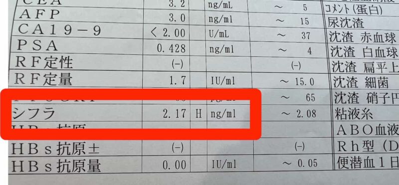 腫瘍マーカー「シフラ」が異常値