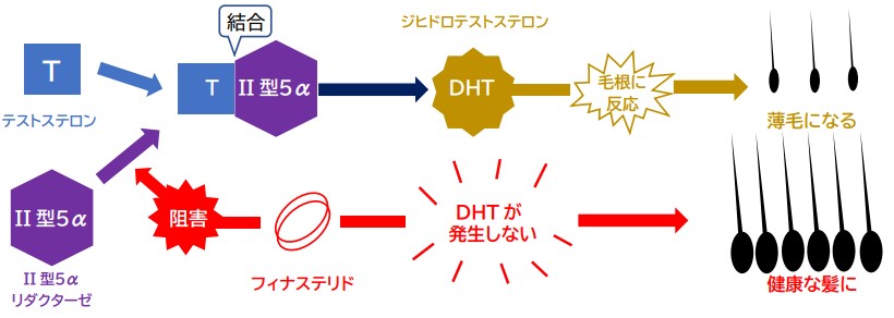 フィナステリドがAGAを改善するメカニズム